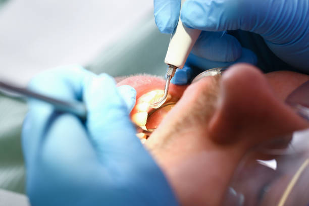Best Emergency Dental Extractions in Mount Shasta, CA